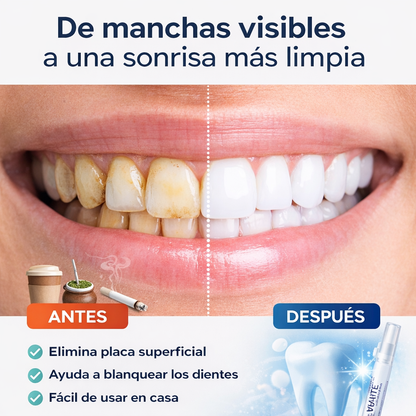 ClearDent Pro® Limpieza profesional en Casa + Gel de regalo